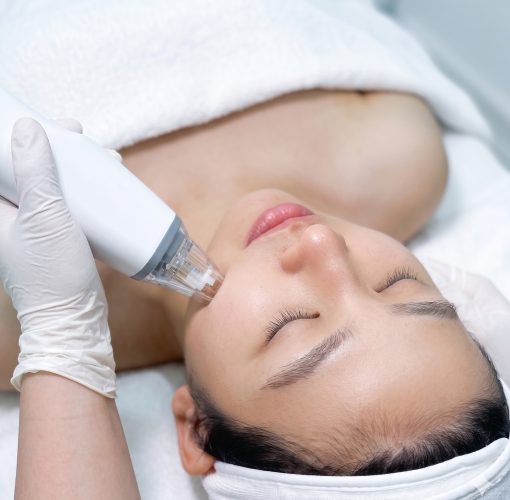 RF Microneedling Singapore