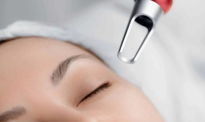 Pico laser | Pigmentating Removal in Singapore