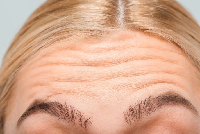 Glowwis Forehead Filler - Medical Aesthetic Clinic In Singapore