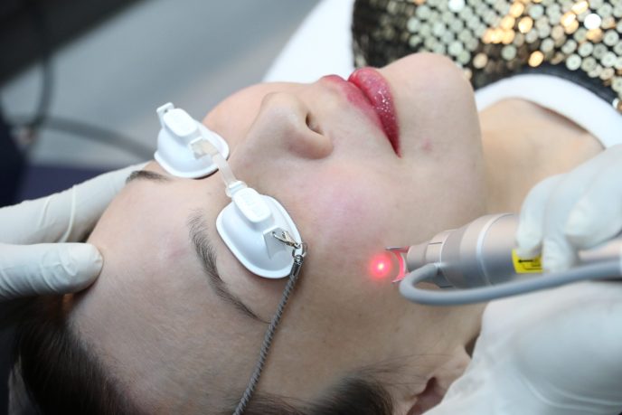 Q-switch laser | Glowwis - Medical Aesthetic Clinic In Singapore